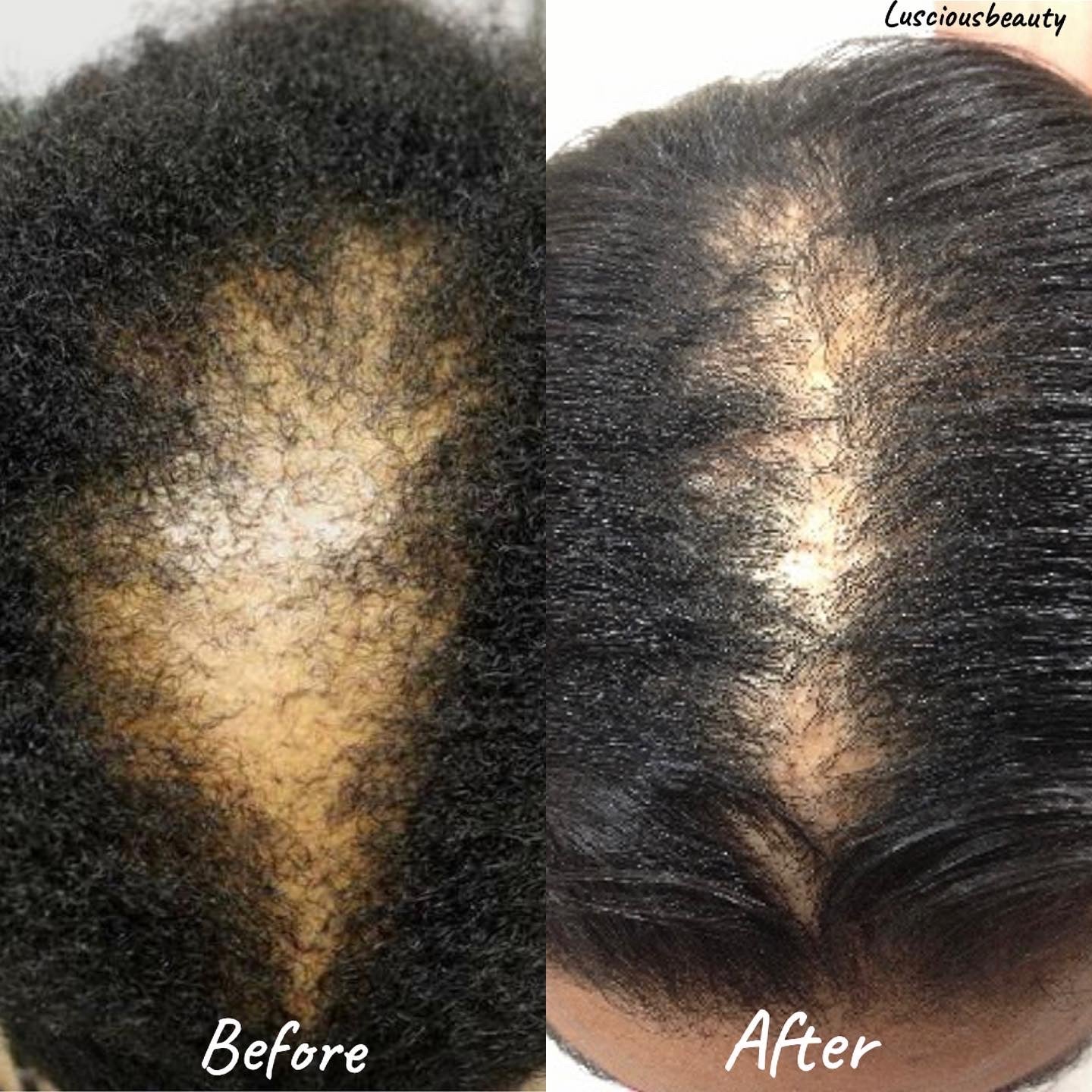 The Ultimate hair growth routine guide - For type 4 hair